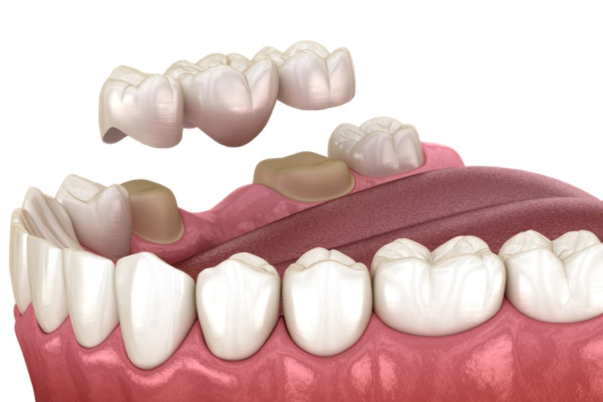 Urat Dentare